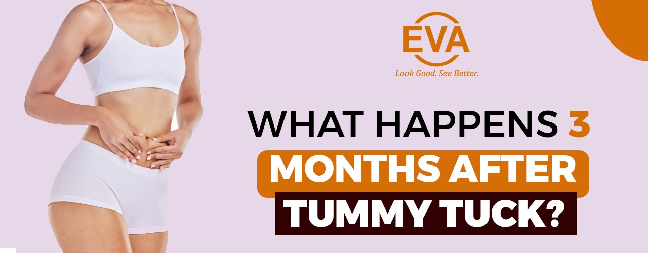 What happens 3 months after Tummy Tuck?