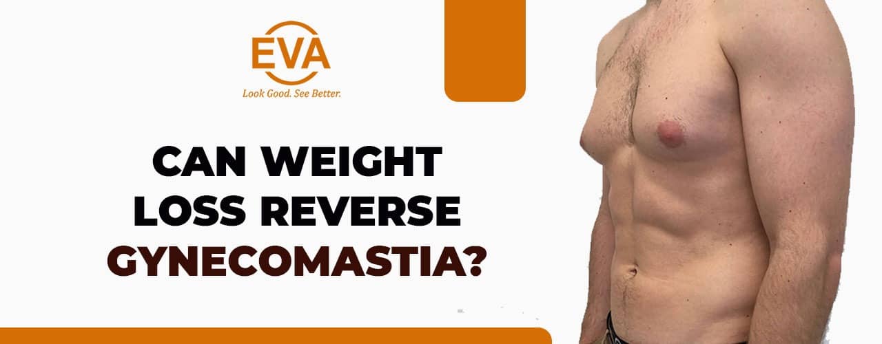 Can Weight Loss Reverse Gynecomastia?