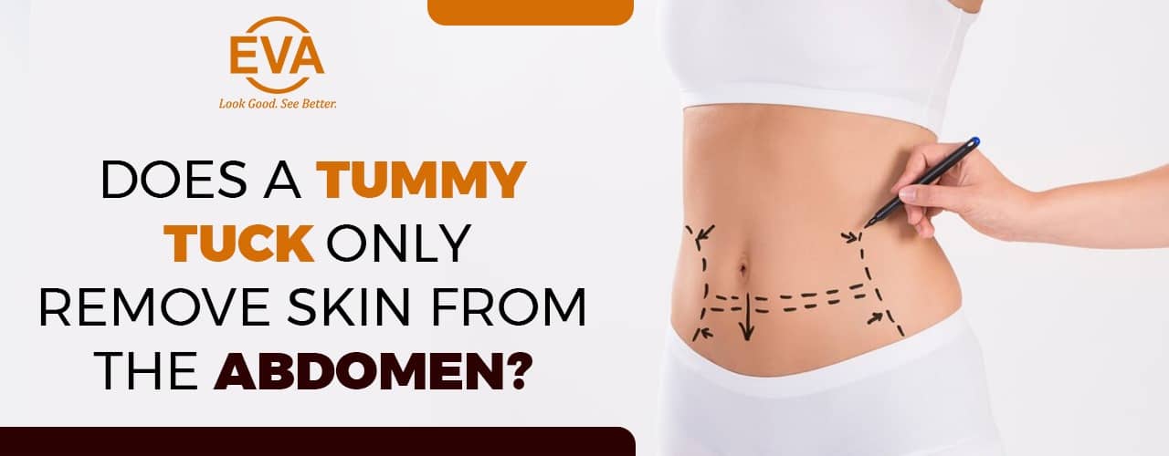 Does a Tummy Tuck only Remove Skin from the Abdomen?