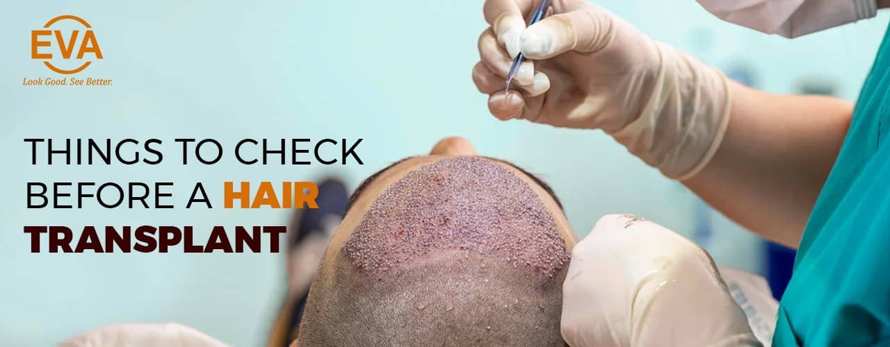 Things to Check Before a Hair Transplant