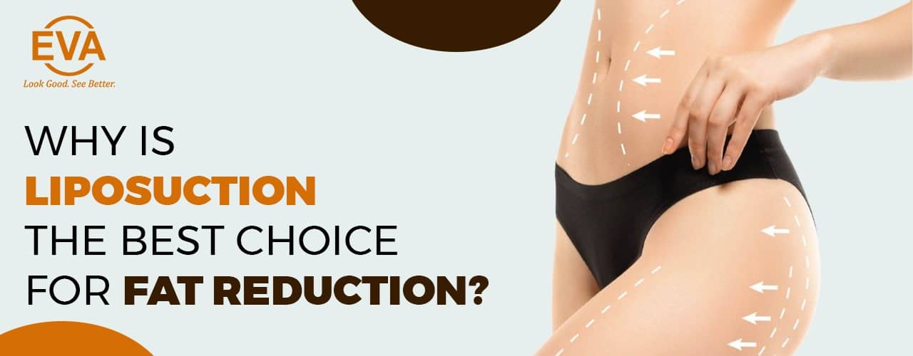 Why is liposuction the best choice for fat reduction?