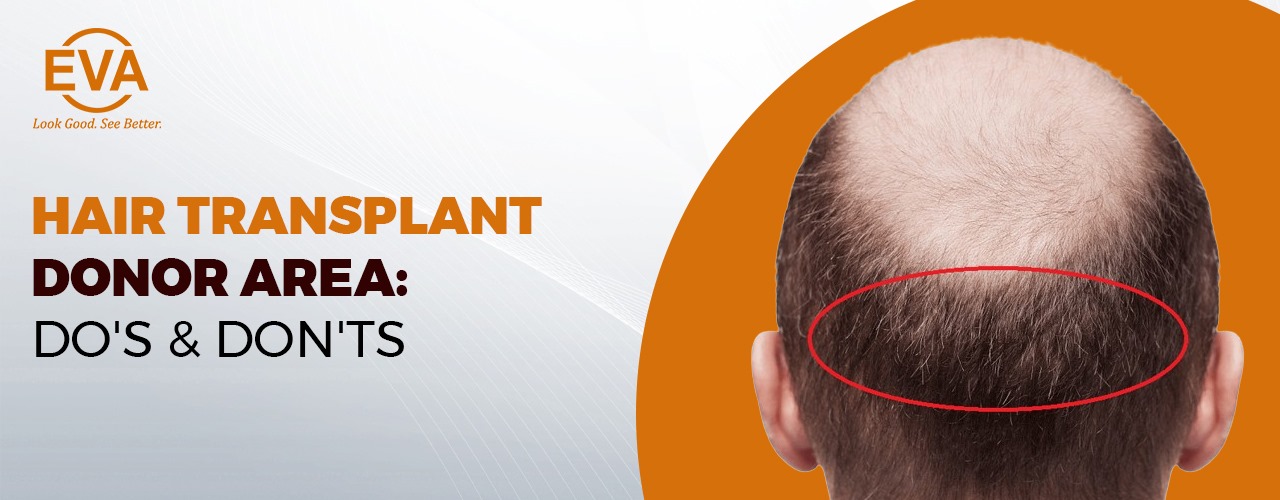 Hair Transplant Donor Area: Do's & Don'ts