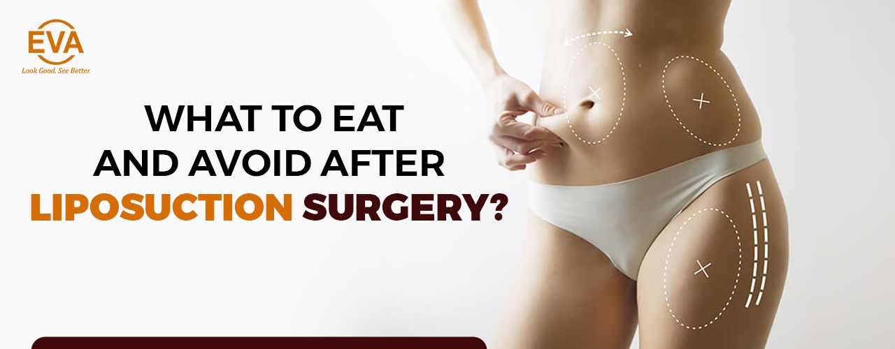 What to Eat and avoid after Liposuction Surgery?