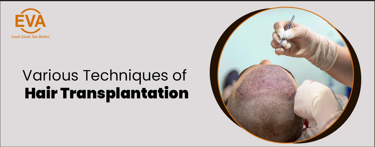 Various Techniques of Hair Transplantation