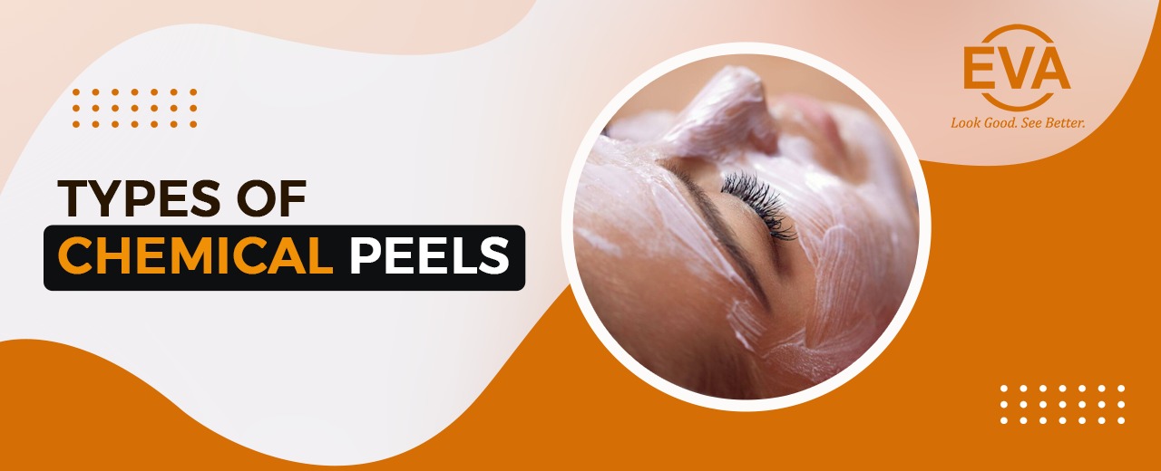 Types of Chemical Peels