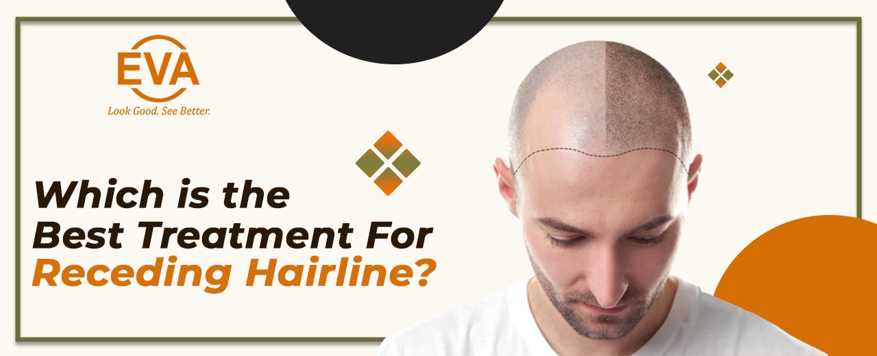 Which is the Best Treatment for Receding Hairline?