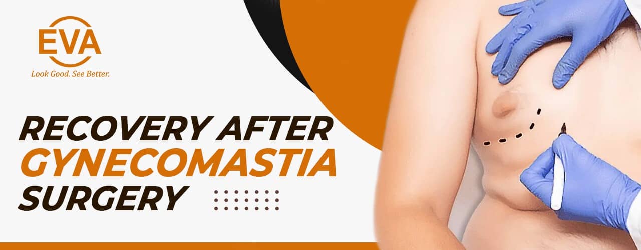 Recovery After Gynecomastia Surgery