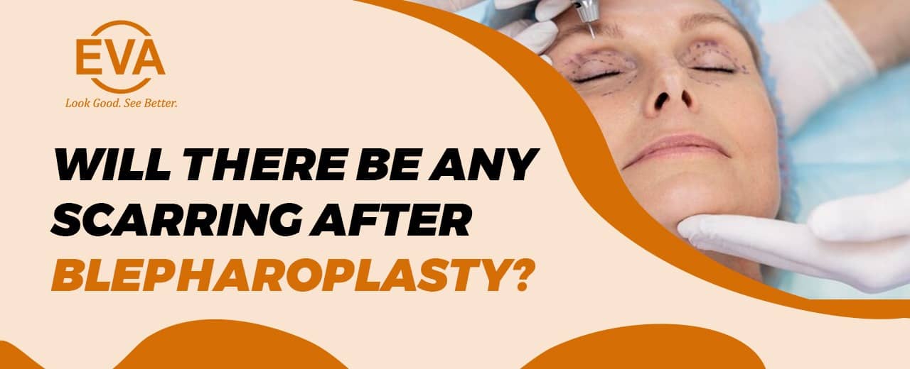 Will there be any Scarring After Blepharoplasty?