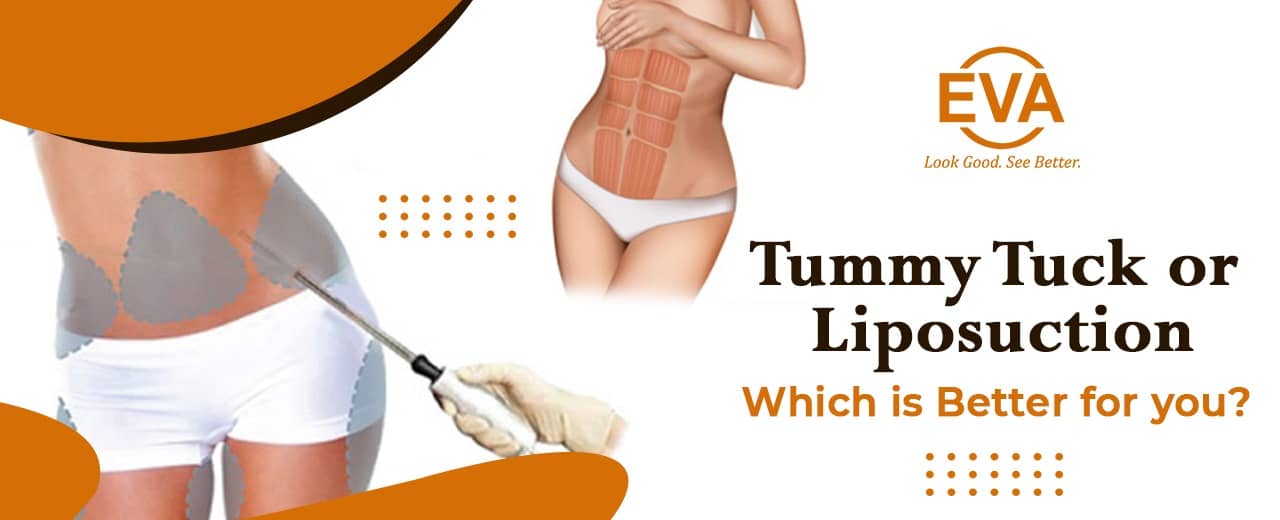 Tummy Tuck or Liposuction: Which is better for you?