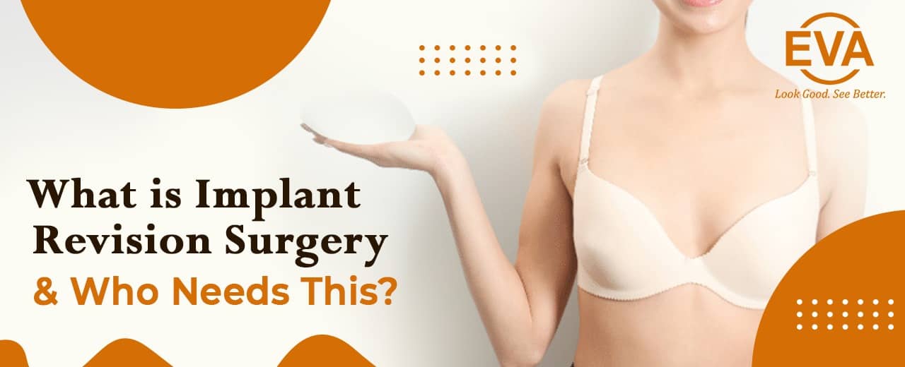 What is Implant Revision Surgery & Who Needs This?