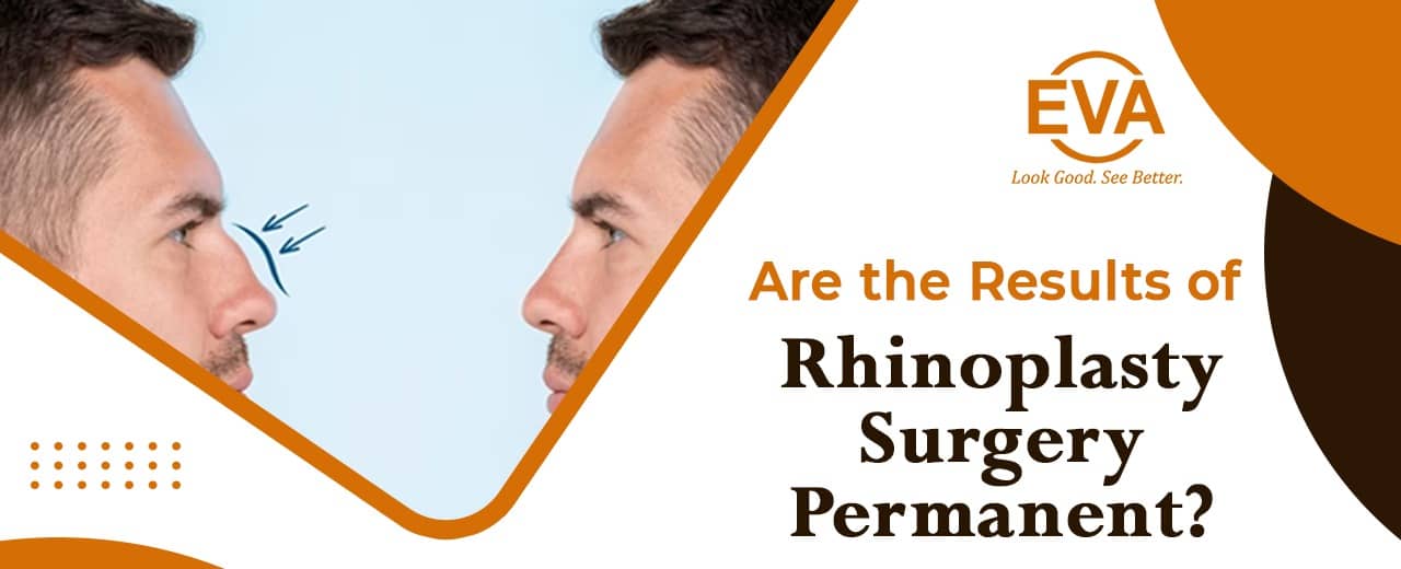 Are the Results of Rhinoplasty Surgery Permanent?