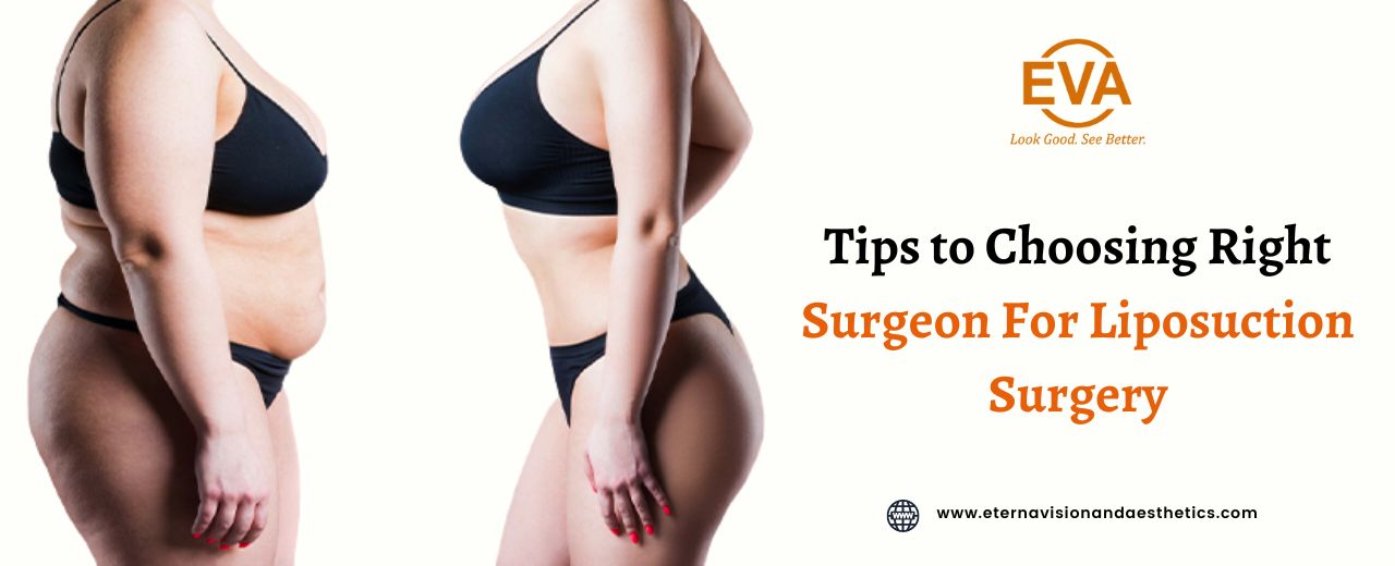 Tips for Choosing The Right Surgeon For Liposuction Surgery