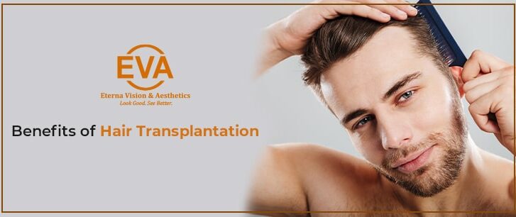 What Are The Benefits of Hair Transplantation?