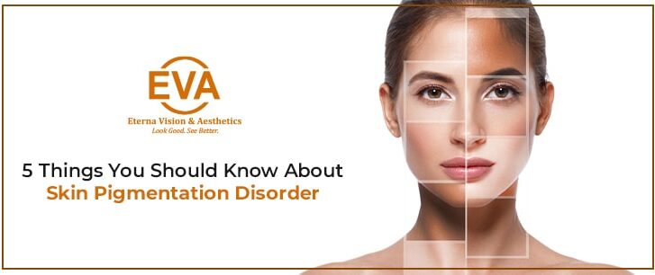 Top 5 Things You Should Know about Skin Pigmentation Disorder