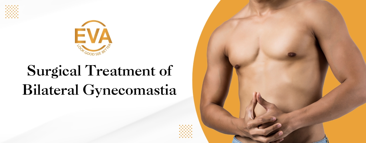 Surgical Treatment of Bilateral Gynecomastia