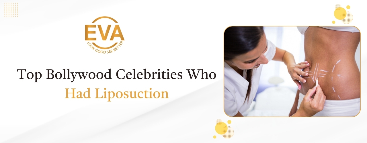 Top Bollywood Celebrities Who Had Liposuction