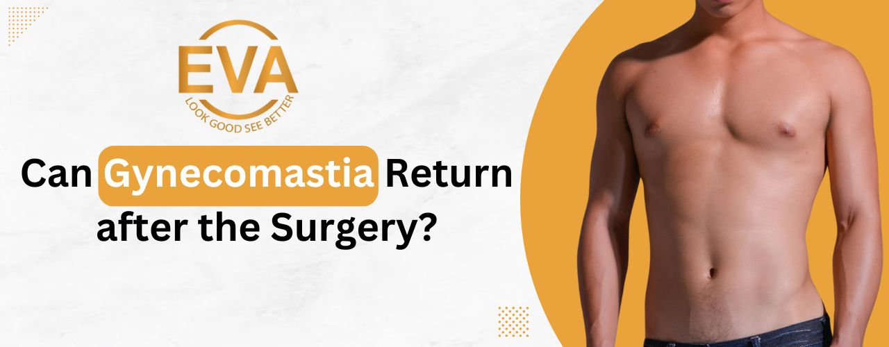 Can Gynecomastia Return after the Surgery