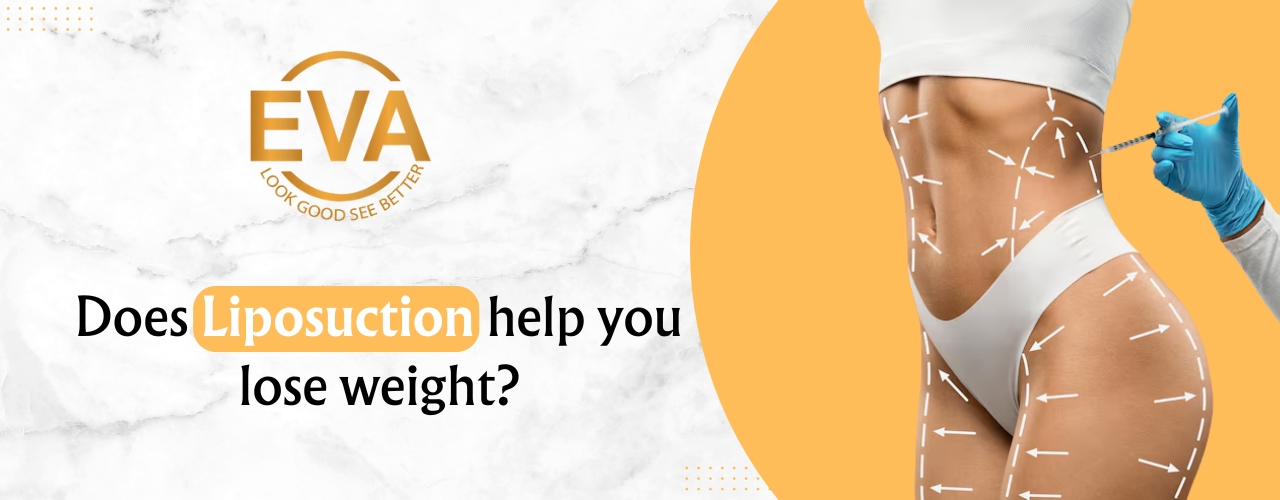 Does liposuction help you lose weight?